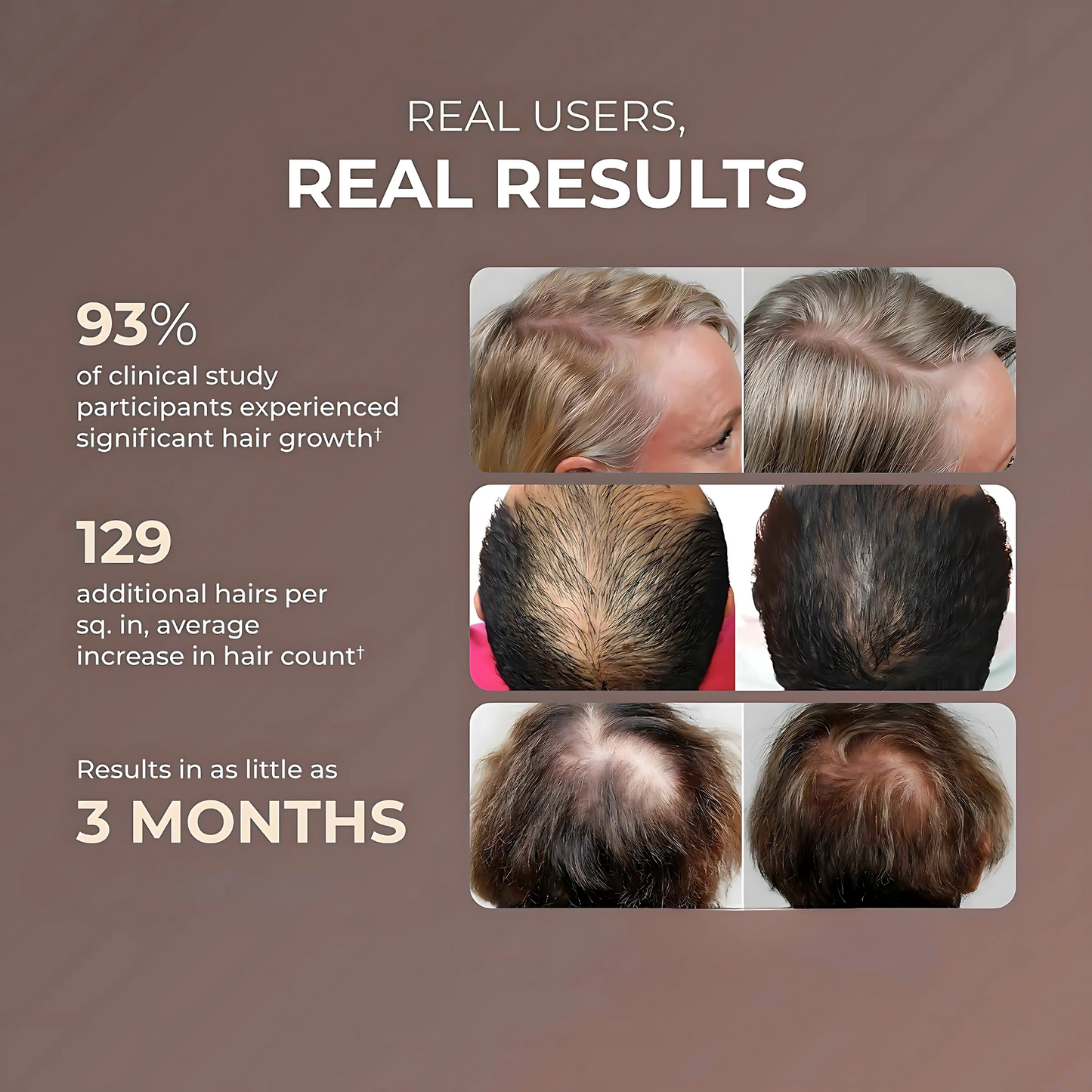 Red Light Cap – Hair Regrowth & Strength