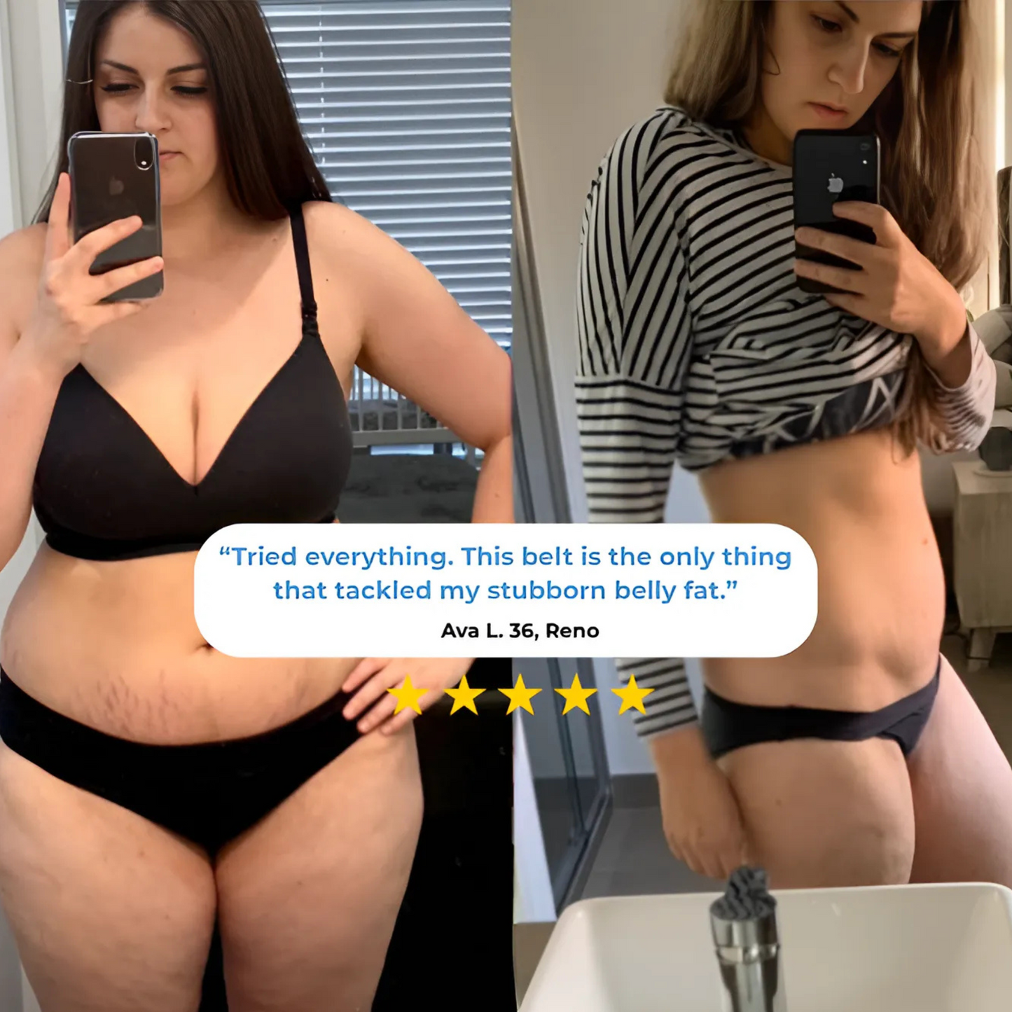 Red Light Therapy Belt – Fade Stretch Marks & Burn Fat